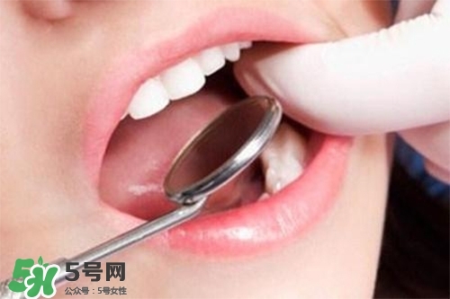 口腔異味是怎么回事？口腔異味怎么清除？