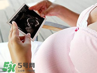 保胎期間可以洗澡嗎？臥床保胎可以洗澡嗎？