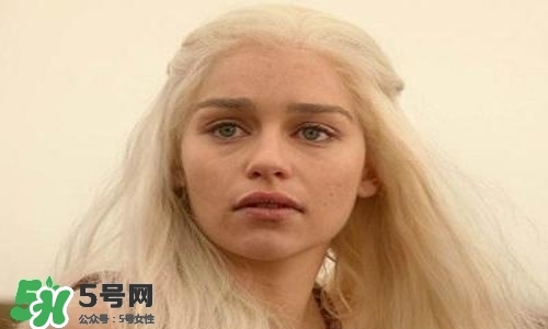 臉色發(fā)黃是什么原因？臉色發(fā)黃吃什么調(diào)理更好？