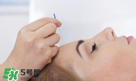 叢集性頭痛會死人嗎？叢集性頭痛的特點