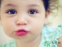 孕期可以激光祛斑嗎？懷孕了能做激光祛斑嗎？