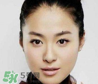 如何預(yù)防臉上長痣？怎樣預(yù)防臉上長痣