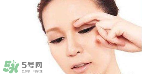 怎樣祛除眼底細(xì)紋？如何去除眼底細(xì)紋