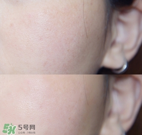 rosamin若美欣杏仁酸精華液怎么樣_好用嗎 rosamin若美欣杏仁酸精華液怎么樣_好用嗎