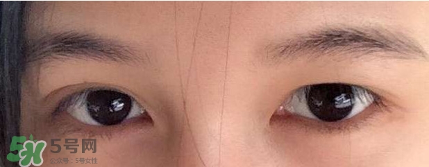 眼睛發(fā)黃是怎么回事？眼睛發(fā)黃是什么原因