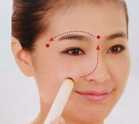 艾灸可以去黑眼圈嗎？艾灸可不可以去黑眼圈