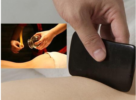 刮痧之后可以拔罐嗎？刮痧之后可不可以拔罐