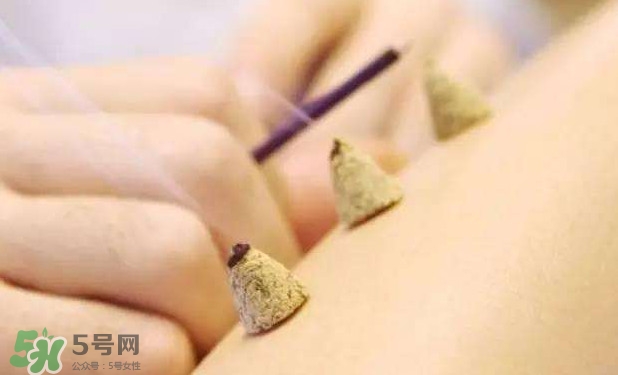 剛懷孕可以艾灸嗎？剛懷孕可以艾灸腹部嗎