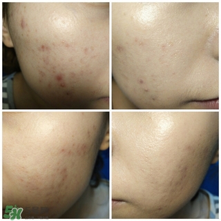 愛(ài)敬氣墊適合什么膚質(zhì) 愛(ài)敬水粉霜適合什么膚質(zhì) 愛(ài)敬氣墊適合什么膚質(zhì) 愛(ài)敬水粉霜適合什么膚質(zhì)