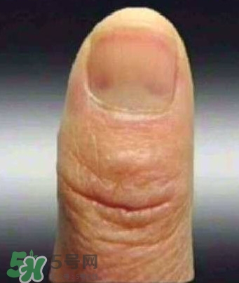 男子指甲35年不剪 指甲與健康的關(guān)系 男子指甲35年不剪 指甲與健康的關(guān)系