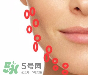 nuface美容儀有效嗎？nuface美容儀副作用？