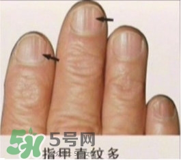 男子指甲35年不剪 指甲與健康的關(guān)系 男子指甲35年不剪 指甲與健康的關(guān)系