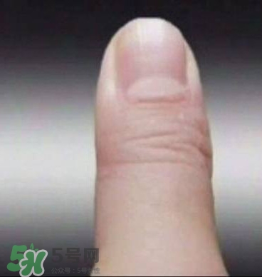 男子指甲35年不剪 指甲與健康的關(guān)系 男子指甲35年不剪 指甲與健康的關(guān)系