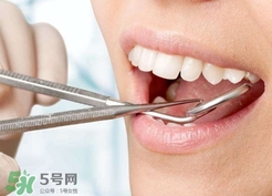 補(bǔ)牙洞需要打麻藥嗎?補(bǔ)牙洞要不要打麻藥? 補(bǔ)牙洞需要打麻藥嗎?補(bǔ)牙洞要不要打麻藥?