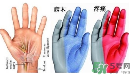 手腳發(fā)麻是缺鈣嗎？手腳發(fā)麻是不是缺鈣