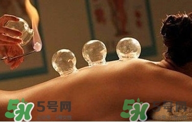 拔火罐疼嗎？拔火罐疼不疼