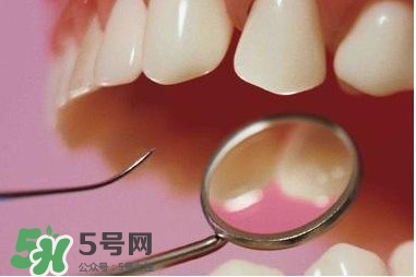 牙周炎傳染嗎？牙周炎會不會傳染