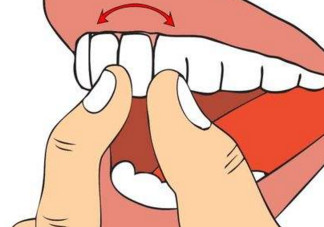 牙齒松動是腎虛嗎？牙齒松動腎陰虛還是陽虛