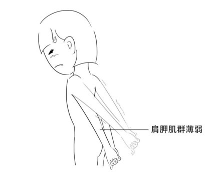 高低肩怎么糾正？高低肩的危害