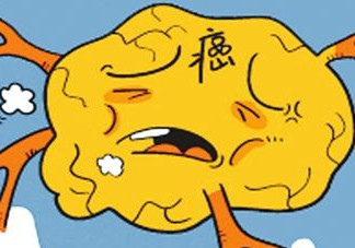 胃癌是怎么引起的？胃癌的早起癥狀