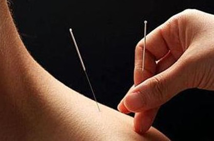 陰雨天能針灸嗎？陰雨天可以針灸嗎