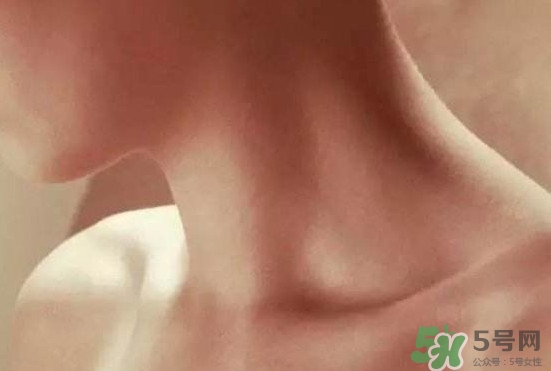 頸椎老化是什么病？頸椎老化的癥狀