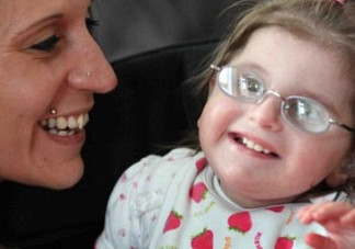 什么是早衰癥？早衰癥初期癥狀