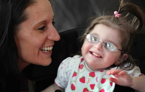 什么是早衰癥？早衰癥初期癥狀