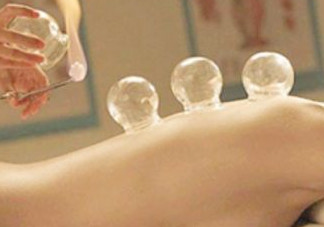 刮痧后可以拔罐嗎？刮痧后能拔火罐嗎