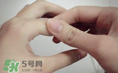 痛風有什么癥狀？女性痛風的初期癥狀