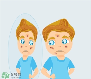 得了痤瘡飲食注意什么？有痤瘡吃東西注意什么