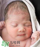 奶癬可以用奶水去除嗎？奶癬可以用奶水擦嗎？