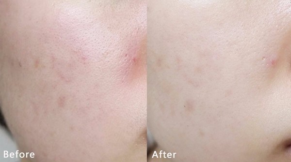 春雨黃油面膜貼怎么用？春雨黃油面膜使用方法