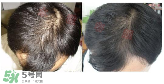  資生堂不老林洗發(fā)水怎么樣？資生堂不老林洗發(fā)水能長頭發(fā)嗎