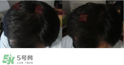  資生堂不老林洗發(fā)水怎么樣？資生堂不老林洗發(fā)水能長頭發(fā)嗎