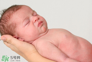 寶寶頭皮上的污垢可以摳掉嗎？寶寶頭上的頭垢該怎么處理？