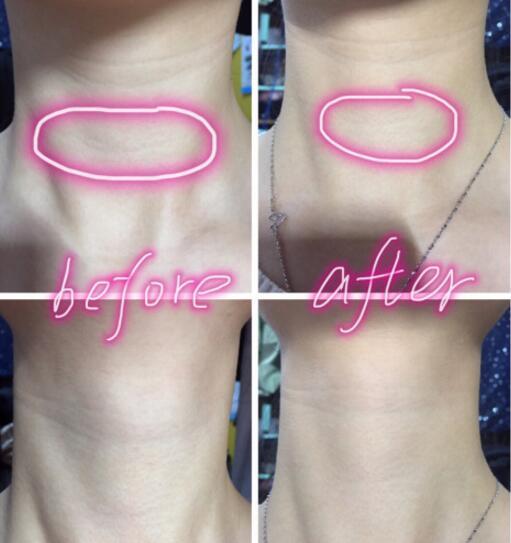 天鵝頸是什么樣的？天鵝頸怎么練？