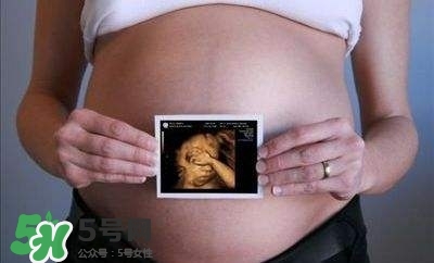 四維彩超能看出男女嗎？四維彩超能看清手指嗎？