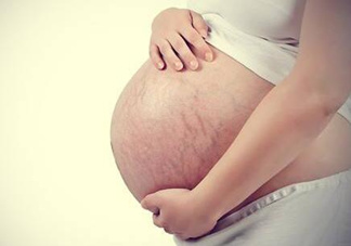 妊娠紋什么時(shí)候長(zhǎng)出來(lái)？哪種皮膚容易長(zhǎng)妊娠紋？