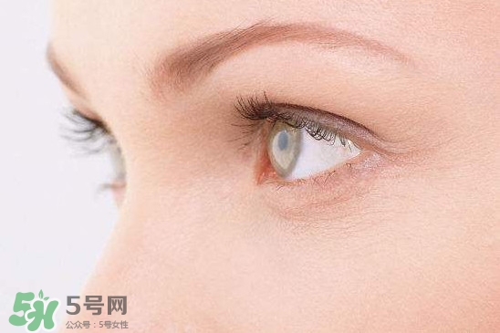 眼睛布滿血絲怎么回事？眼睛布滿血絲怎么辦