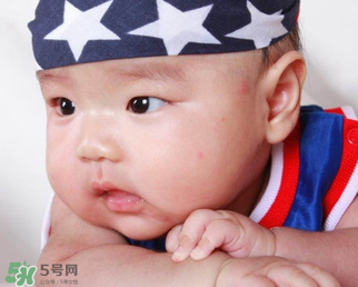 嬰兒被蚊子咬了如何去紅點？被蚊子咬后紅點如何去除？