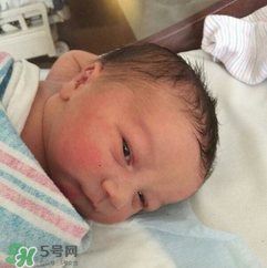 新生兒手握避孕環(huán)出生是怎么回事？出生后健康嗎？