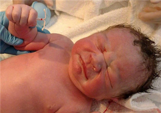 新生兒手握避孕環(huán)出生是怎么回事？出生后健康嗎？