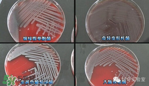 三文魚有刺嗎？三文魚的刺怎么處理