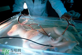 人造子宮能生孩子嗎？人造子宮成功案例