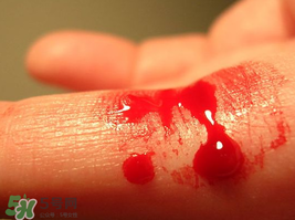 尸血會感染艾滋嗎？尸血可以治療血友病嗎？