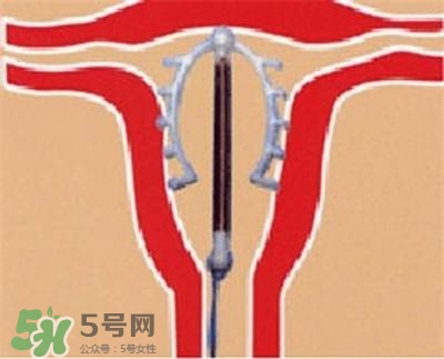 避孕環(huán)安全嗎？避孕環(huán)是什么樣子的圖片