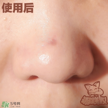 melty berry去黑頭使用方法 melty berry草莓鼻去黑頭怎么用 melty berry去黑頭使用方法 melty berry草莓鼻去黑頭怎么用