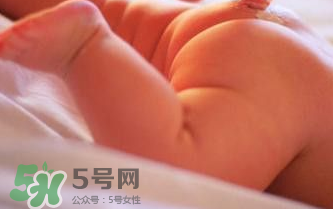 寶寶尿布疹可以擦紅霉素軟膏嗎？紅霉素軟膏對尿布疹有效嗎？