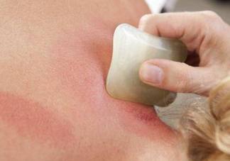 夏天刮痧好嗎？夏天拔罐好還是刮痧好？